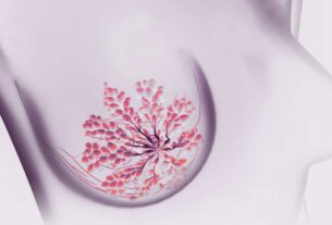 cancer du sein gene diminuer dangers femmes