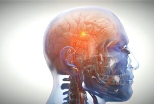 ropirinole médicament parkinson maladie de charcot